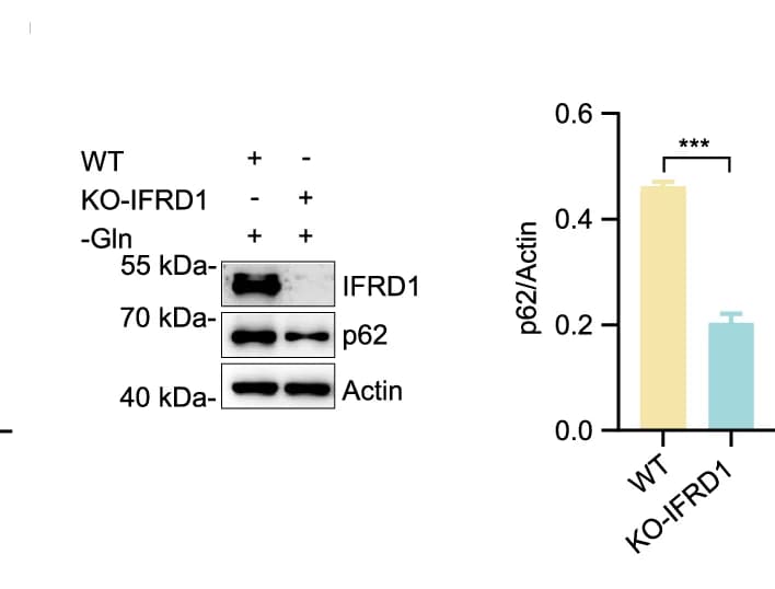 Open access visualization of Bar Plot, Error Bars, Gel, Immunoblot, Proteins