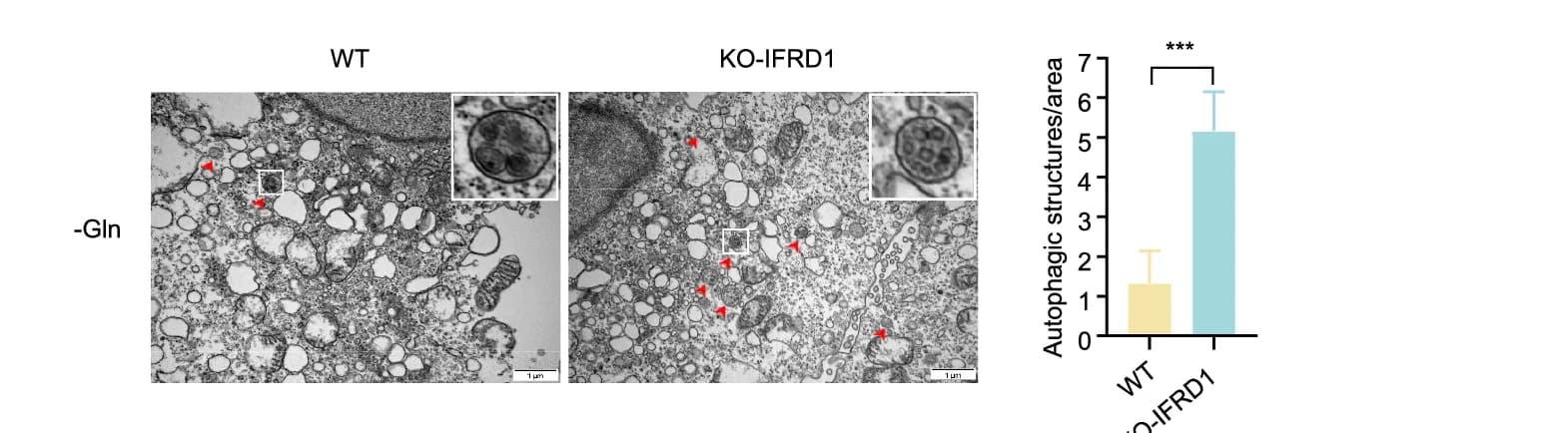 Open access visualization of Microscopy, Bar Plot, Error Bars, Electronic Micrographs, Autophagosomes