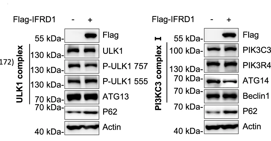 Open access visualization of Gel, Immunoblots, ULK1 Complex, PI3KC3 Complex I, HepG2 Cells