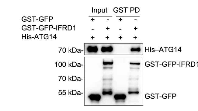 Open access visualization of Gel, IFRD1, ATG14, GST Pull-Down, Immunoblot