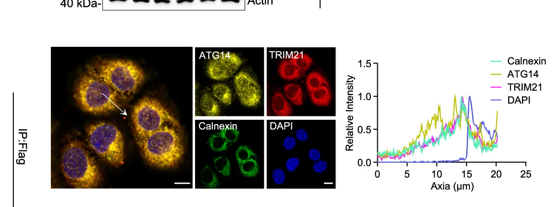 Open access visualization of Line Plot, Microscopy, Gel, Immunoblots, ATG14