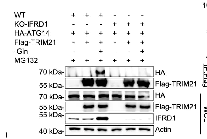 Open access visualization of Gel, IP, TRIM21, ATG14, WT