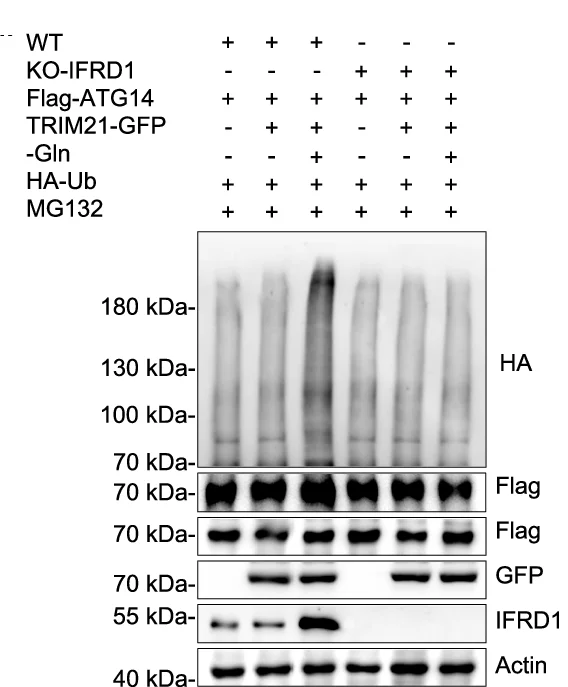 Open access visualization of Gel, IP, TRIM21, Ubiquitination, ATG14