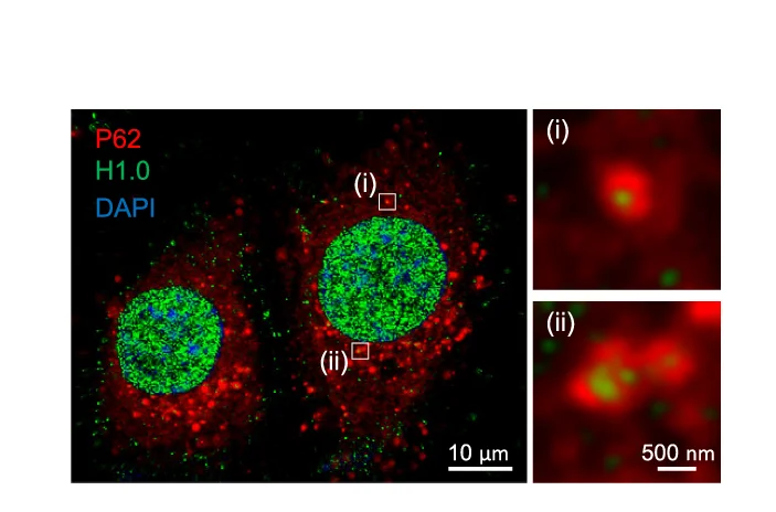Open access visualization of Microscopy, PLC/PRF/5 Cells, Glutamine Starvation, Baf-A1