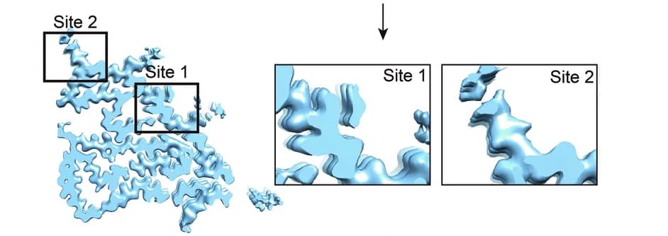 Open access visualization of Protein Structure, Cryo-EM Maps, TMEM106B, PiB, Fibrils