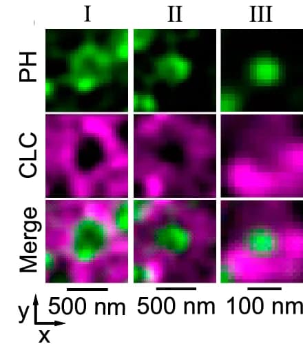 Open access visualization of Microscopy, STED XY-Plane Images, PH G, SNAP-CLC-SiR, Pre-Ω