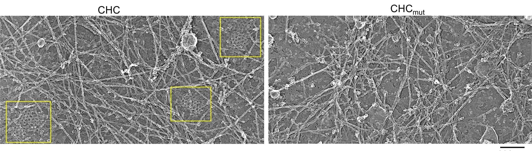 Open access visualization of Microscopy, Platinum Replica EM Images, Clathrin Patch Density, Cells, Clathrin Trimerization