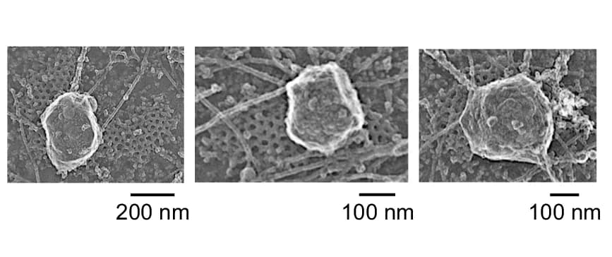 Open access visualization of Microscopy, Platinum Replica EM Images, Control Cells, Clathrin Lattices, Membrane Structures