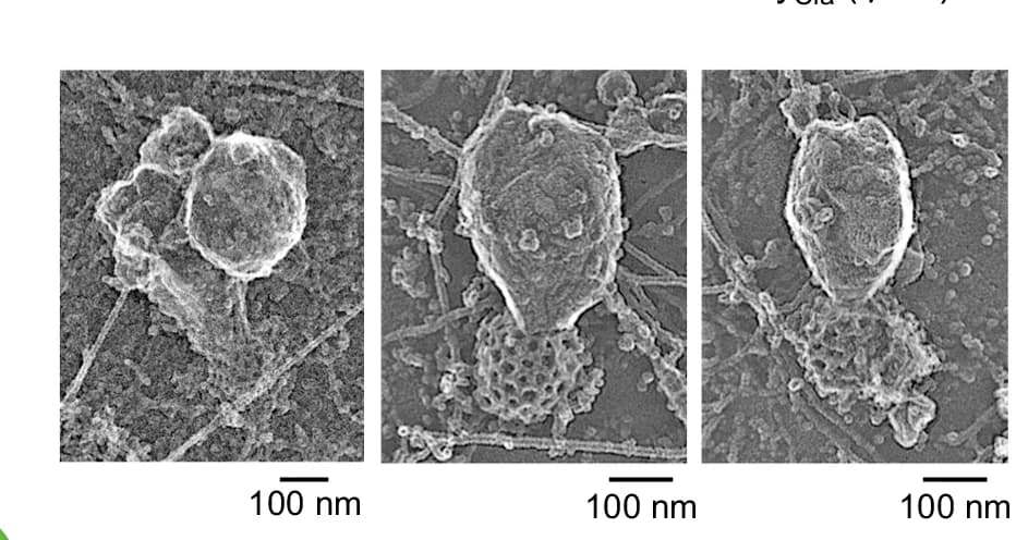 Open access visualization of Microscopy, Platinum Replica EM Images, Clathrin Lattices, Membrane Structures