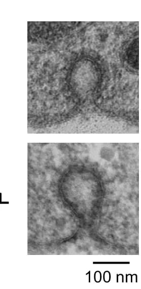 Open access visualization of Microscopy, Electron Microscopy, Clathrin-Coated Pits, Chromaffin Cells