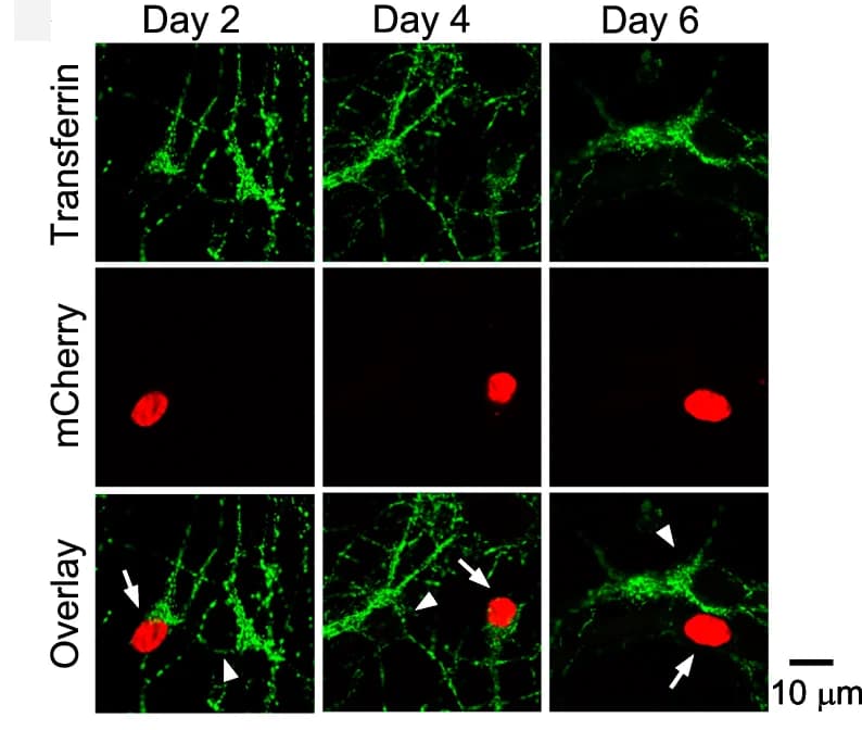 Open access visualization of Microscopy, Alexa 488-conjugated Transferrin Uptake, Cell Bodies, Chc Loxp/Loxp Hippocampal Neurons, Cre/mCherry Transfection