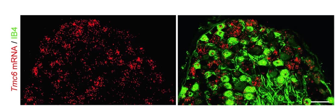 Open access visualization of Microscopy, ISH, Immunostaining, Tmc6, Mouse