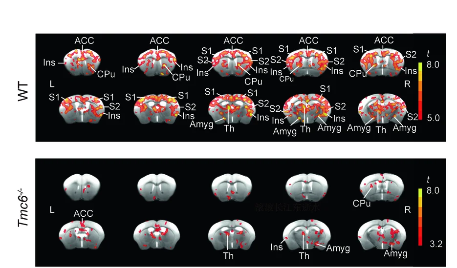 Open access visualization of Heatmap, Functional Magnetic Resonance Imaging, fMRI, WT Mice, Tmc6 Knockout Mice