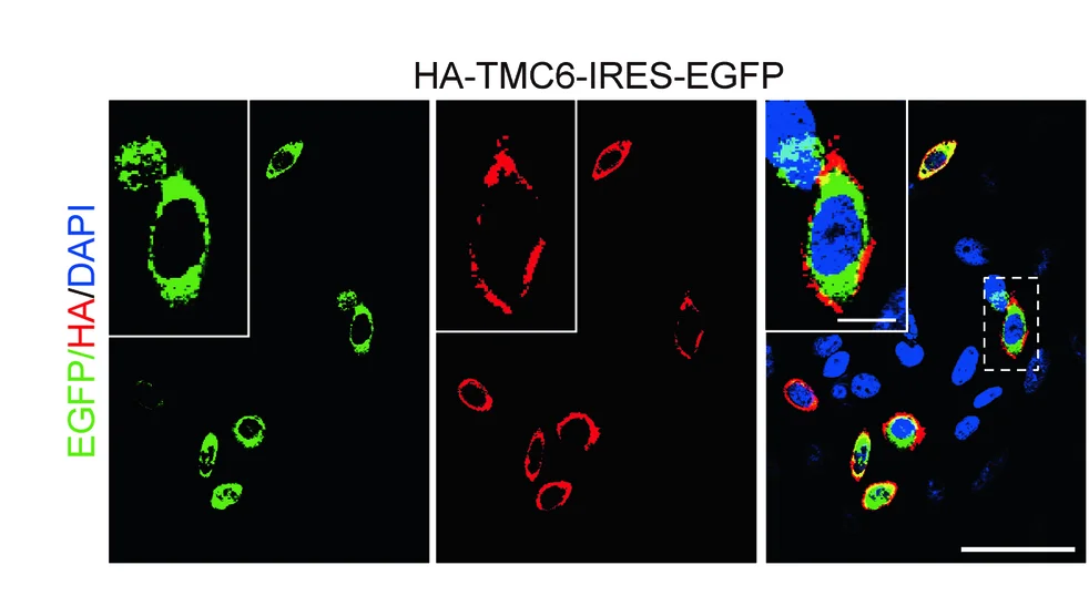 Open access visualization of Microscopy, Live Cell Labeling, CHO Cells, HA-tagged, EGFP-tagged