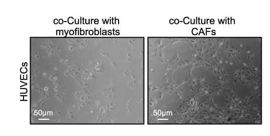 Open access visualization of Microscopy, HUVEC Tube Formation Assay, Myofibroblasts, CAFs, HUVEC Tubule Formation