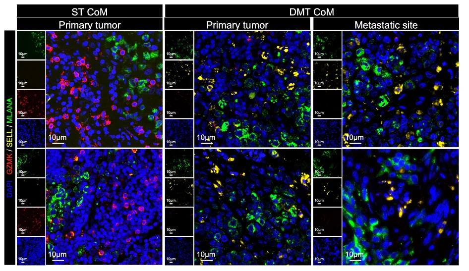 Open access visualization of Microscopy, IF Staining, Immune Microenvironment, ST Samples, DMT Samples