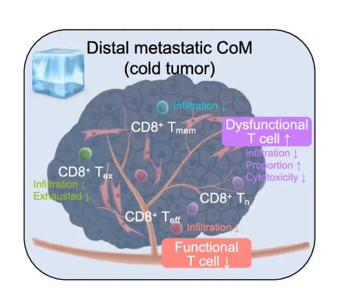 Open access visualization of Illustration, Workflow, Schematic Diagram, CD8+ T Cells, Distant Metastatic CoM