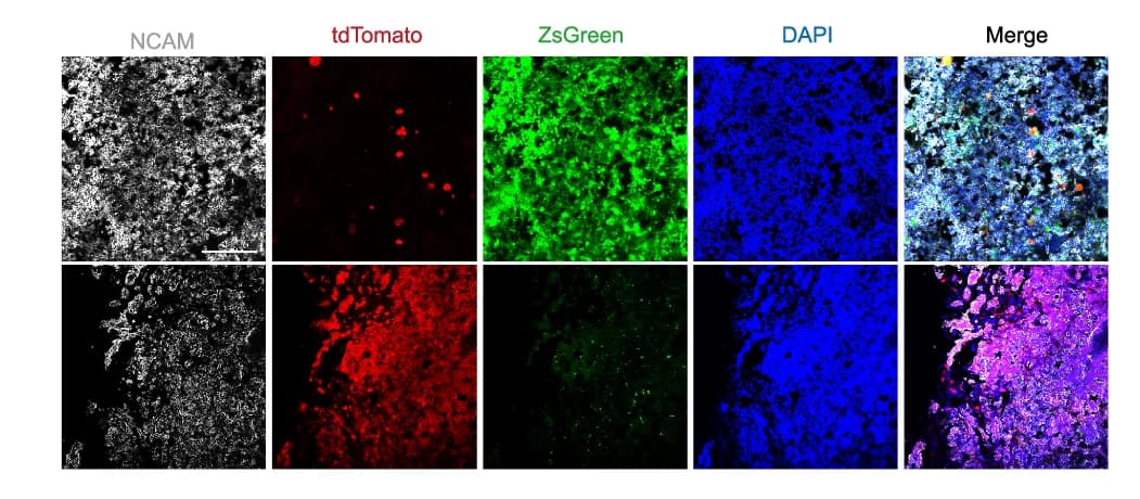 Open access visualization of Microscopy, Photo, Immunostaining, NCAM, ZsGreen