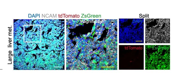 Open access visualization of Microscopy, Immunostaining, NCAM, ZsGreen, tdTomato