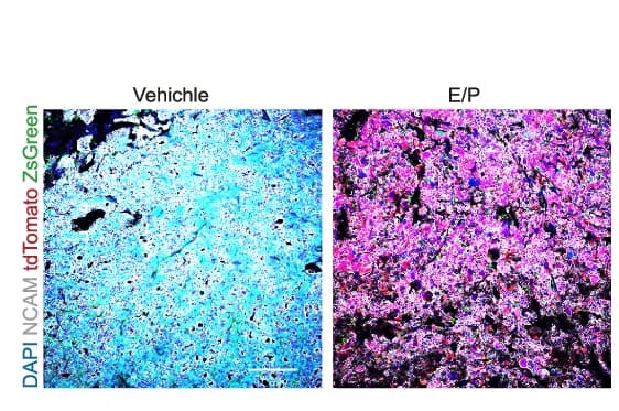 Open access visualization of Microscopy, Immunostaining, NCAM, ZsGreen, tdTomato