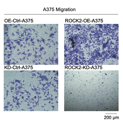 Open access visualization of Microscopy, ROCK2, Migration, A375 Cells, Transwell Assay