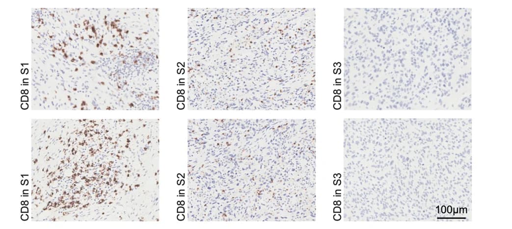 Open access visualization of Microscopy, IHC, CD8, Immune Clusters