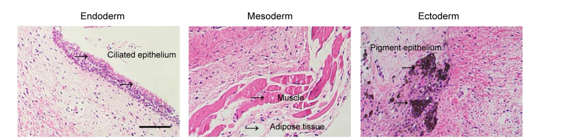 Open access visualization of Microscopy, Hematoxylin and Eosin Staining, pESCs-derived Teratomas, Teratomas