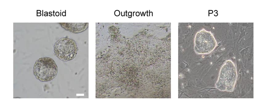 Open access visualization of Microscopy, Morphology, Outgrowth, pESCs, Blastoids