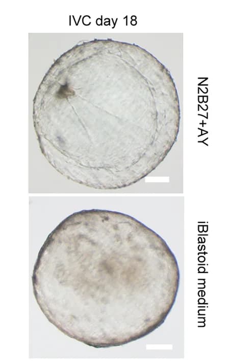 Open access visualization of Microscopy, In Vitro, Blastoids, Morphology