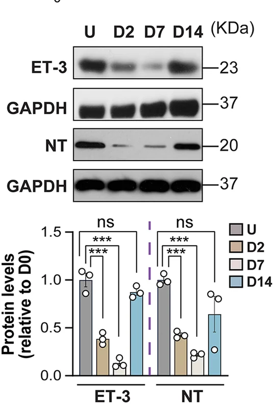 Open access visualization of Bar Plot, Error Bars, Gel, Western Blot Analysis, ET-3/NT