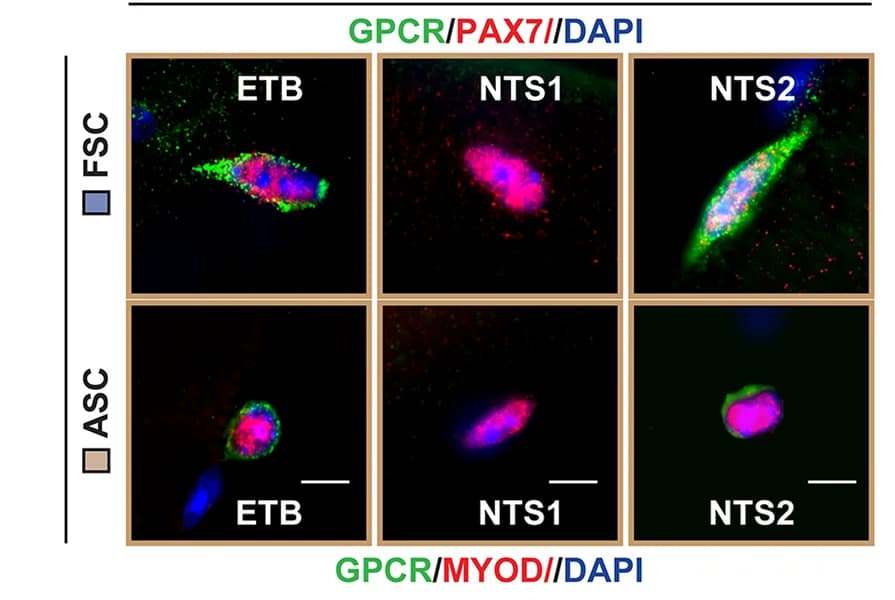 Open access visualization of Microscopy, Immunostaining, ET B, NTS 1, NTS 2