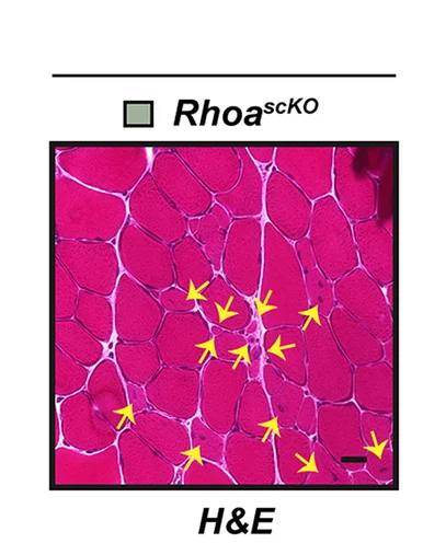 Open access visualization of Microscopy, H&E Staining, Rhoa scKO, TA Muscles