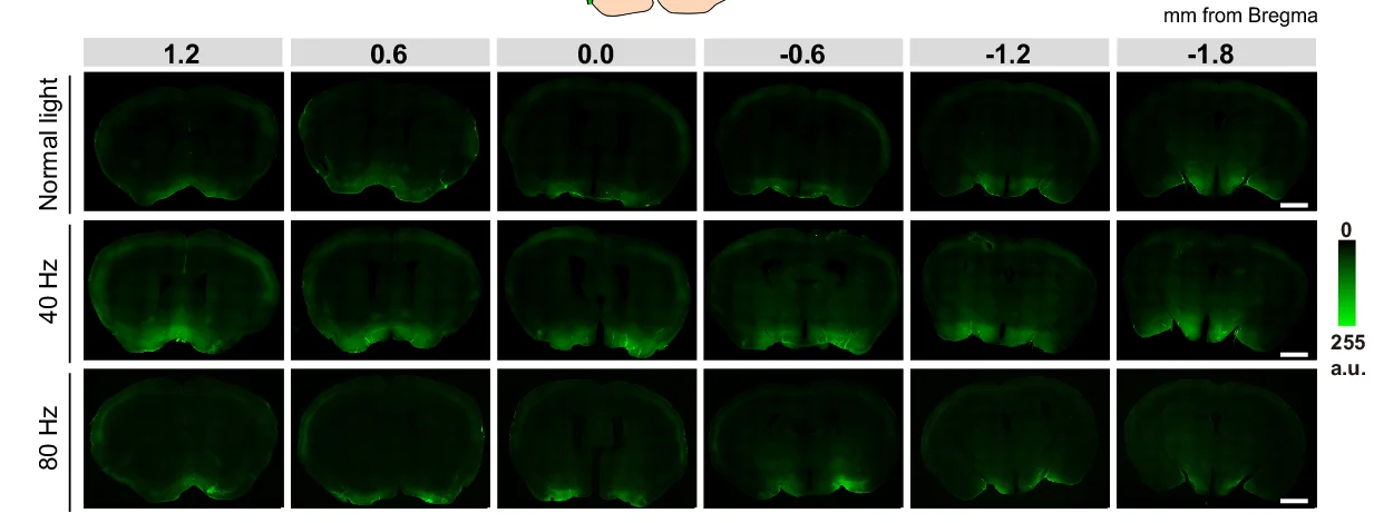 Open access visualization of Microscopy, Light Flickering, Parenchymal Distribution, CSF Tracer, Brain Images