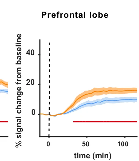 Open access visualization of Line Plot, Error Bars, Signal Intensity Plots, Signal Change, Baseline