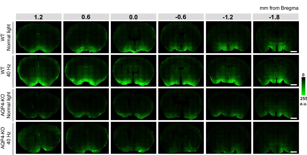 Open access visualization of Microscopy, Fluorescence, Coronal Brain Sections, Y39-1 Tracer, Cisterna Magna