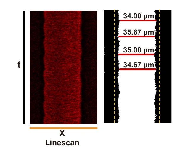 Open access visualization of Microscopy, Photo, X-t Scans, Edge Detection, Luminal Diameter