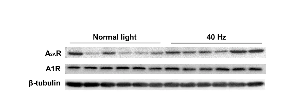 Open access visualization of Gel, Western Blot, Brain Extracts, A2AR, A1R