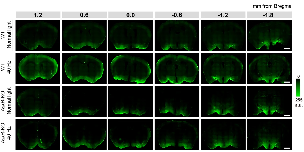 Open access visualization of Microscopy, Fluorescence, Coronal Brain Sections, Y39-1 Tracer, Cisterna Magna