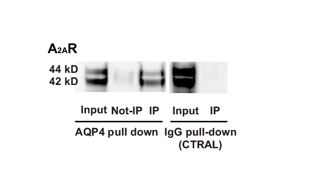 Open access visualization of Gel, Western Blot, AQP4, A2AR, Cell Culture