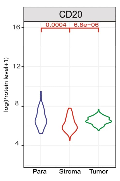 Open access visualization of Violin Plot, CD20 Protein, Tumor Nest, Tumor Stroma, Para-Tumor