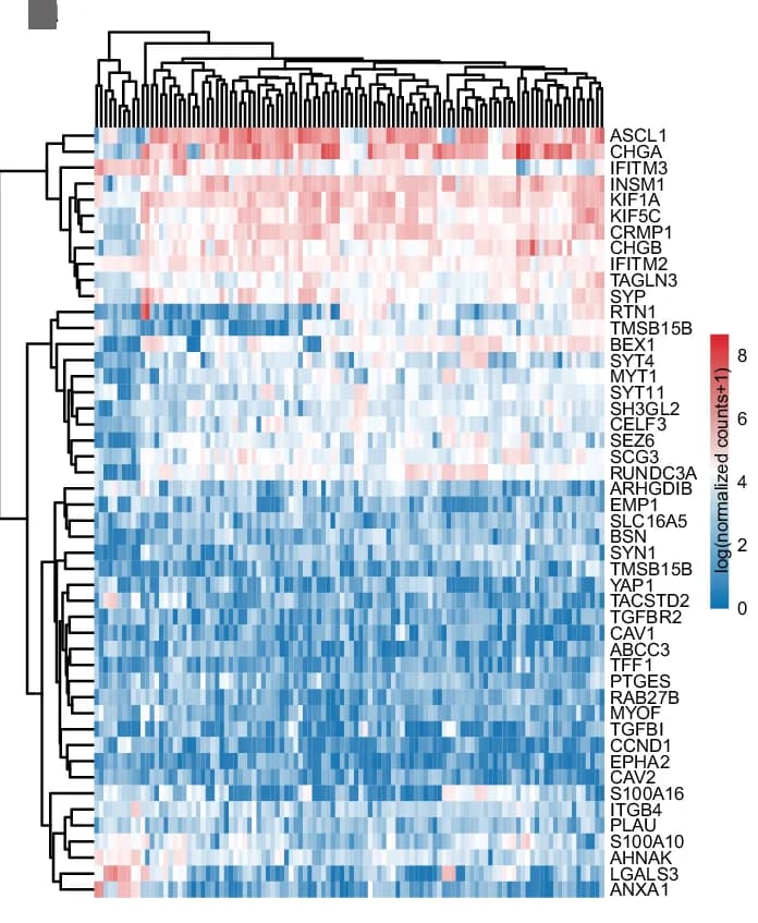 Open access visualization of Heatmap, Clustered, NE Marker Genes, Tumor Nest, ROIs