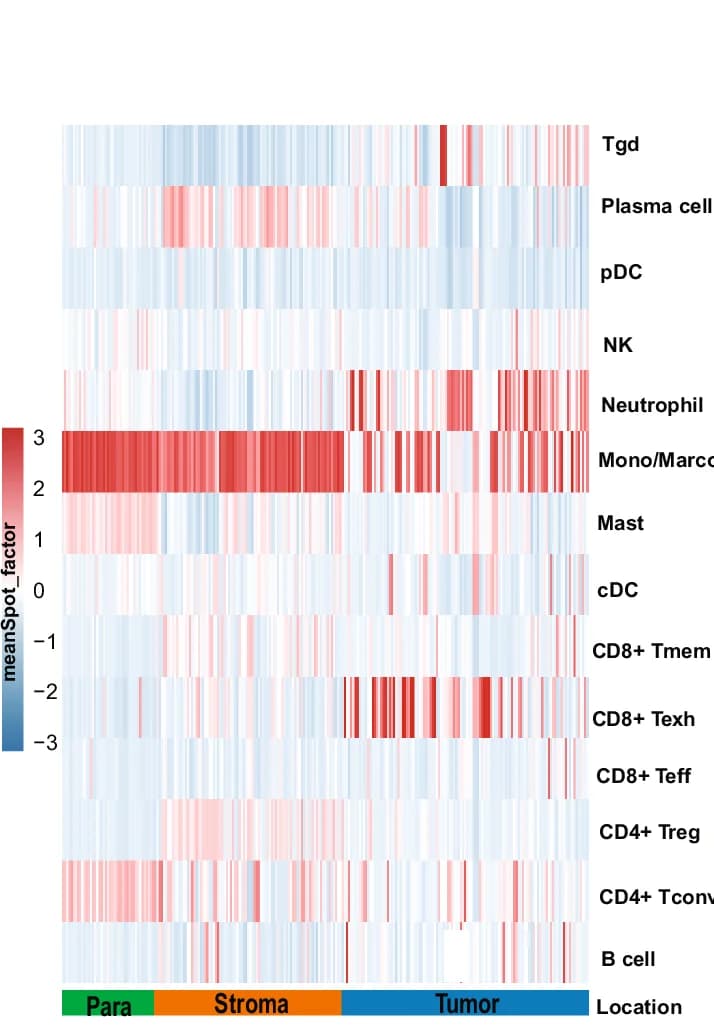 Open access visualization of Heatmap, Spot Factor, Immune Cells, Cell2location