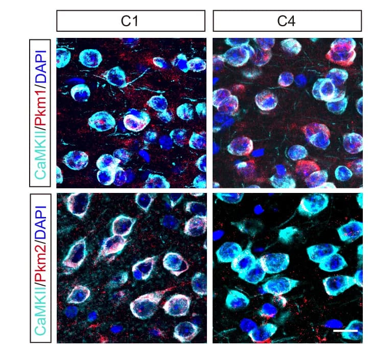 Open access visualization of Microscopy, Immunofluorescence, Antibodies, Pkm1, Pkm2