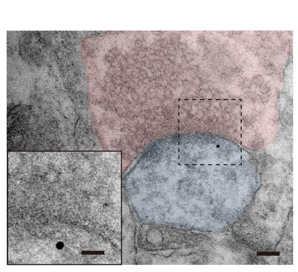 Open access visualization of Microscopy, Immunoelectron Microscope, Mouse, mPFC, Anti-Pkm2