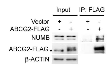 Open access visualization of Gel, Co-immunoprecipitation, NUMB, ABCG2, ABCG2-FLAG Plasmid