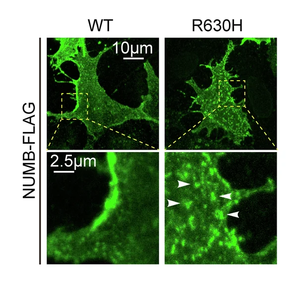 Open access visualization of Microscopy, NUMB WT, NUMB R630H, Protein Distribution, HEK293 Cells