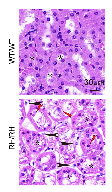 Open access visualization of Microscopy, H&E Staining, Kidney Tissue, WT/WT Mice, NUMB R632H/NUMB R632H Mice