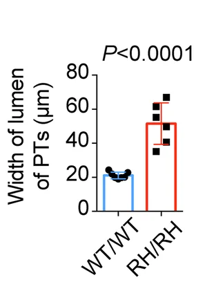 Open access visualization of Bar Plot, Error Bars, Proximal Tubules, Lumen Width, WT/WT Mice