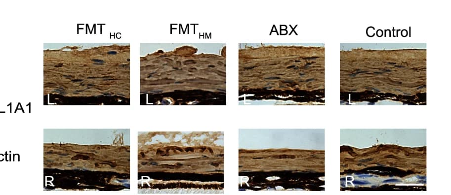 Open access visualization of Microscopy, Protein Levels, COL1A1, Sclera, Immunofluorescence