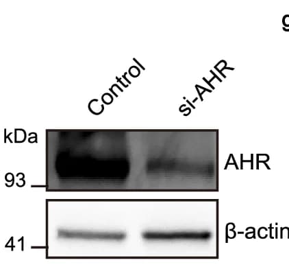 Open access visualization of Gel, AHR Protein, Western Blot, Protein Levels